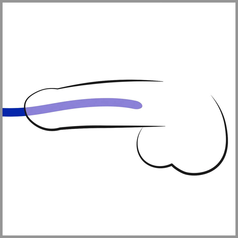 You2Toys - Komplet silikonowych dilatorów — zdjęcie 3